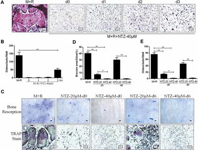 Nitazoxanide, an <mark class="highlighted">Antiprotozoal</mark> Drug, Reduces Bone Loss in Ovariectomized Mice by Inhibition of RANKL-Induced Osteoclastogenesis